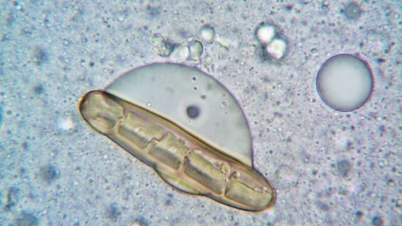 Cyclosporiasis Outbreak Spreads to 31 States, Over 800 Cases Reported